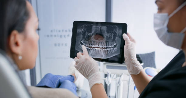 Licensed Tooth Extraction service in Dublin, CA - Smile Center Dentistry